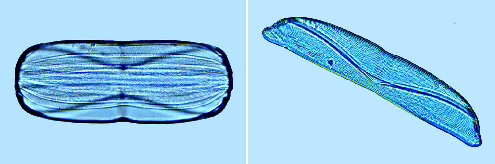 Amphora Amphora obtusa